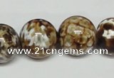 CAB614 15.5 inches 18mm round leopard skin agate beads wholesale