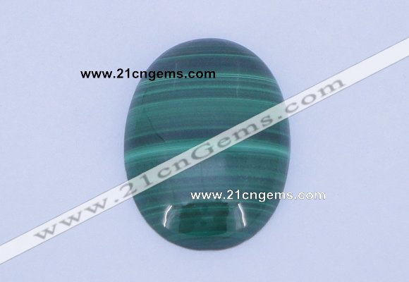 CGC02 20PCS 4*6mm oval natural malachite gemstone cabochons