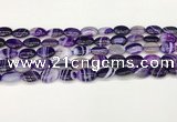 CAA4646 15.5 inches 10*14mm oval banded agate beads wholesale