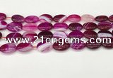 CAA4663 15.5 inches 13*18mm oval banded agate beads wholesale