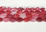 CAA4664 15.5 inches 13*18mm oval banded agate beads wholesale