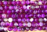 CAA6377 15 inches 8mm round fuchsia banded agate beads wholesale