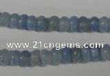 CAG4371 15.5 inches 5*8mm rondelle dyed blue lace agate beads