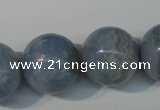 CAG4377 15.5 inches 20mm round dyed blue lace agate beads