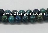 CCS72 15.5 inches 14mm round dyed chrysocolla gemstone beads