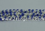 CPB542 15.5 inches 8mm round Painted porcelain beads