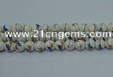 CPB591 15.5 inches 6mm round Painted porcelain beads