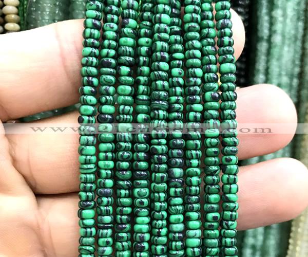 CRB5475 15 inches 2.5*4mm rondelle imitation malachite beads
