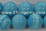 CTU2588 15.5 inches 20mm round synthetic turquoise beads